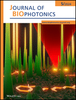 Cover: Journal of Biophotonics