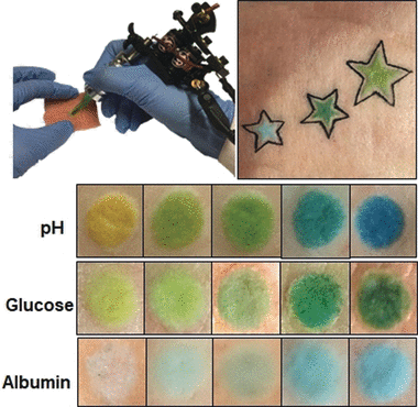 The Art of Sensing within the Skin: Dermal tattoo sensors for the detection of blood pH change and metabolite levels